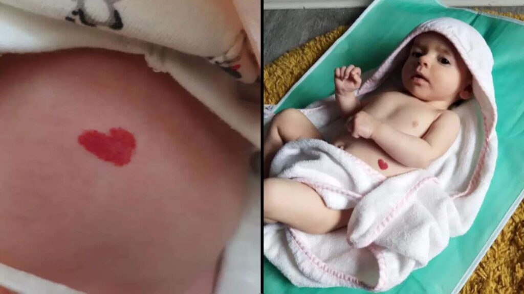 Heart Shaped Birthmark Significance